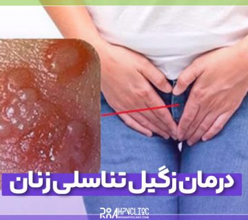 درمان زگیل تناسلی زنان