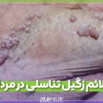 علائم زگیل تناسلی در مردان