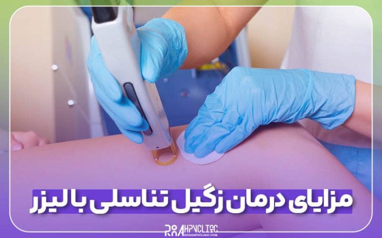 مزایای درمان زگیل تناسلی با لیزر