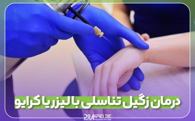 درمان زگیل تناسلی با کرایوتراپی یا لیزر؟ کدام روش بهتر است؟ 5 کرایوتراپی زگیل تناسلی