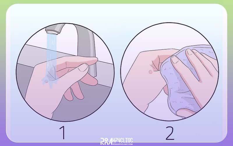 روش سوم تمیز و خشک کردن زگیل