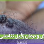 درمان زگیل تناسلی زنان