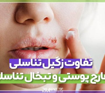 تفاوت زگیل تبخال تناسلی