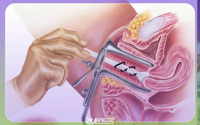 تست پاپ اسمیر چیست و چگونه انجام میشود؟ + بهترین سن آزمایش pap smear 10 تست پاپ اسمیر چه نتایجی دارد؟
