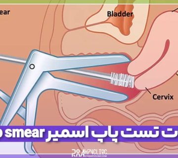 تست پاپ اسمیر