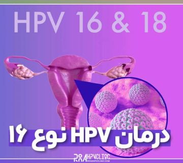 hpv 16