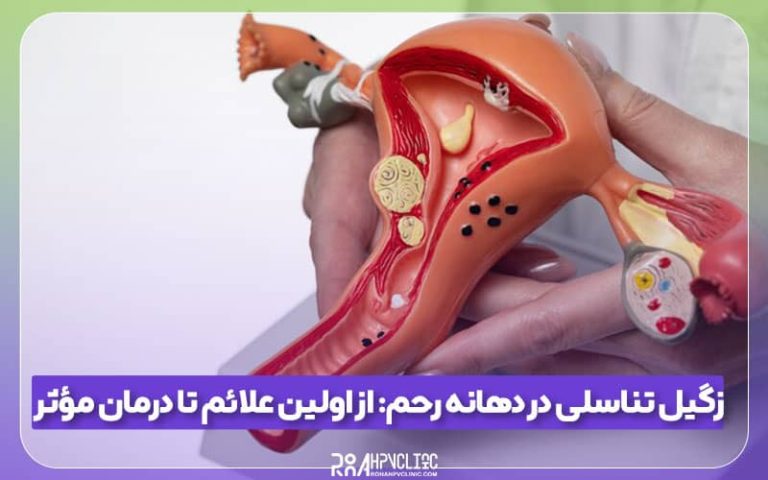 علائم زگیل تناسلی در دهانه رحم