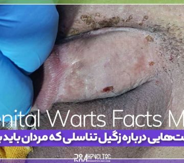 genital-warts-facts-men