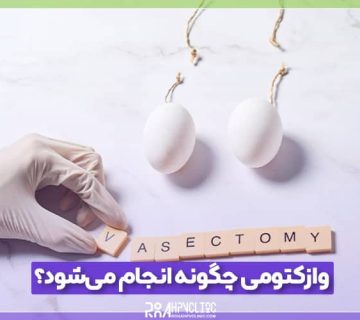 چگونه انجام می شود 1