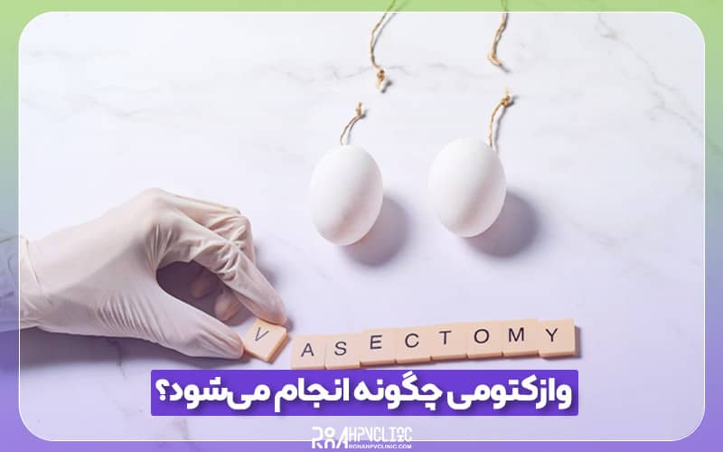 چگونه انجام می شود 1