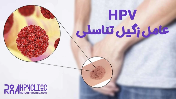 اچ پی وی عامل زگیل تناسلی