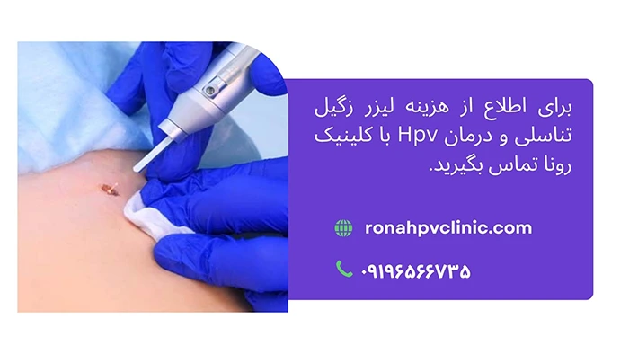 لیزر رگیل تناسلی