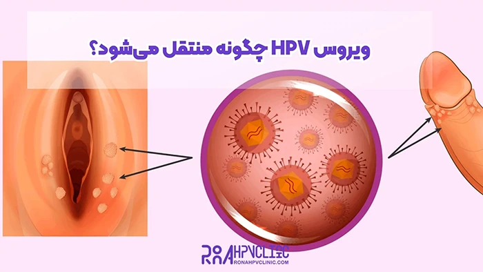 ویروس HPV چگونه منتقل میشه