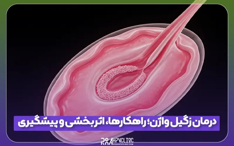 درمان زگیل واژن؛ راهکارها، اثربخشی و پیشگیری