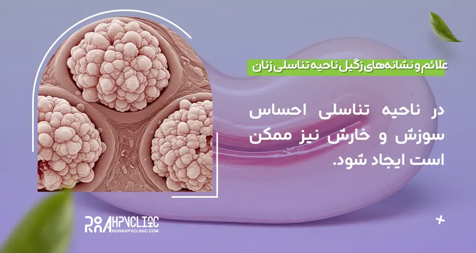 درمان زگیل واژن راهکارها، اثربخشی و پیشگیری 3 علائم و نشانههای زگیل ناحیه تناسلی زنان