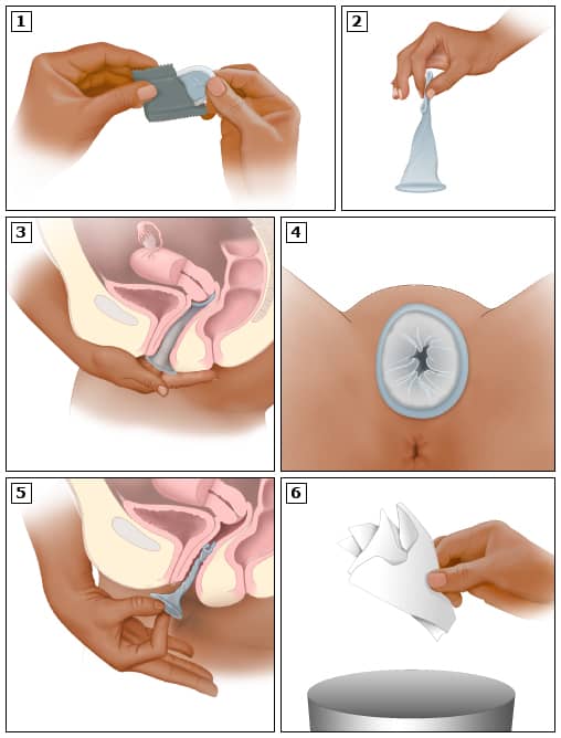 کاندوم زنانه