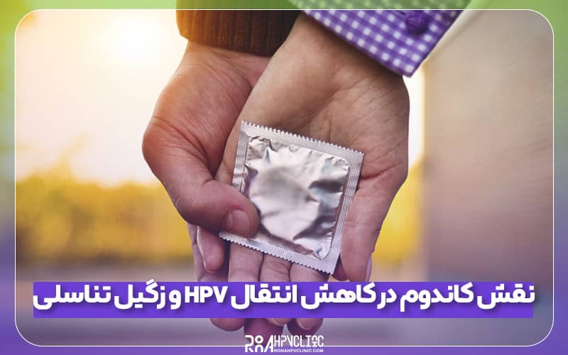 نقش کاندوم در کاهش انتقال HPV