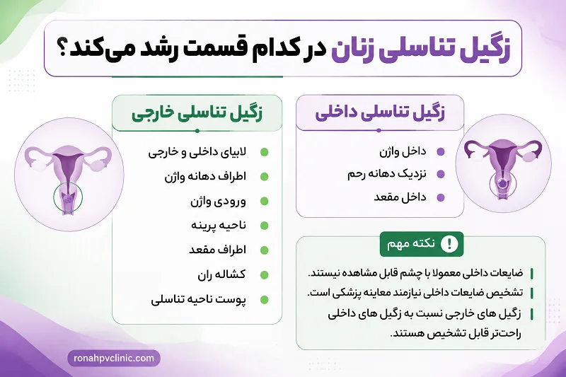 علت زگیل تناسلی در زنان | علائم و درمان + تفاوت با سایر ضایعات 16 زگیل تناسلی در زنان کجا رشد می کند؟