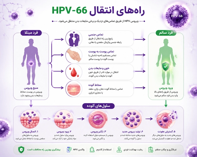 انواع تایپ های زگیل تناسلی 20 راههای انتقال HPV 66 و نحوه پیشگیری در زنان و مردان