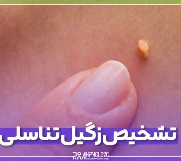 راهنمای تشخیص زگیل تناسلی در زنان و مردان