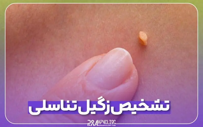 راهنمای تشخیص زگیل تناسلی در زنان و مردان