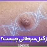 زگیل سرطانی چیست و نحوه درمان آن چگونه است؟