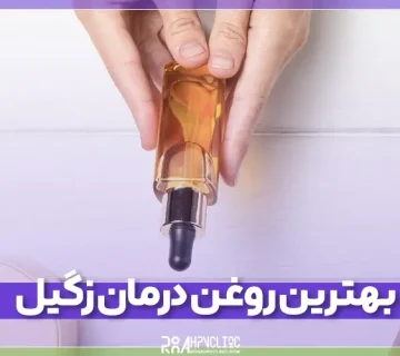 معرفی بهترین روغن درمان زگیل