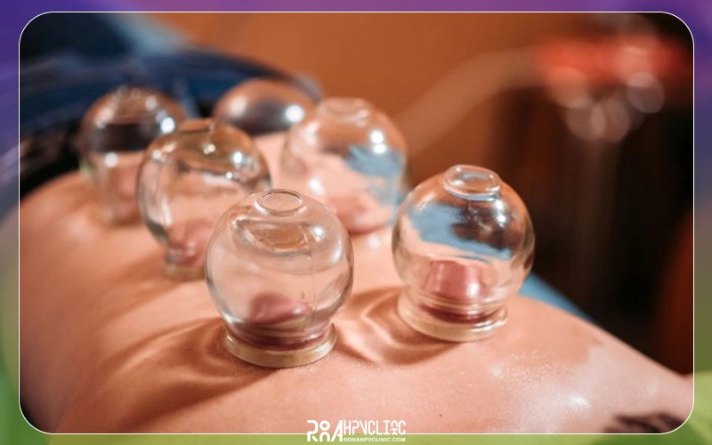 خطرات حجامت برای زگیل تناسلی و احتمال عود آن