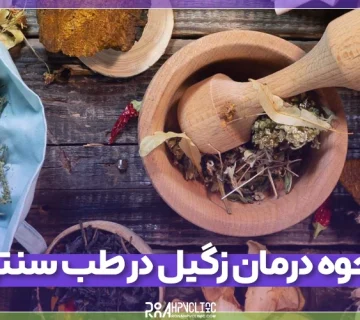 نحوه درمان زگیل در طب سنتی با اقدامات تخصصی