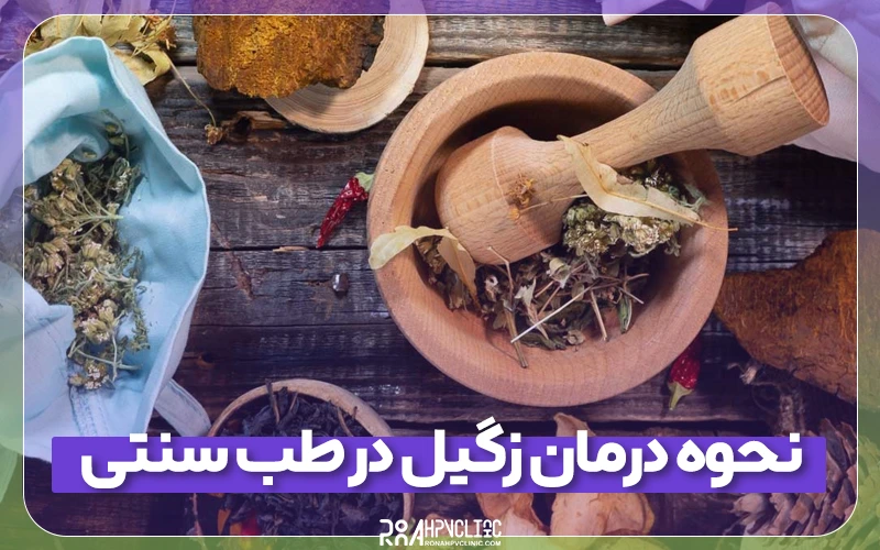 نحوه درمان زگیل در طب سنتی با اقدامات تخصصی