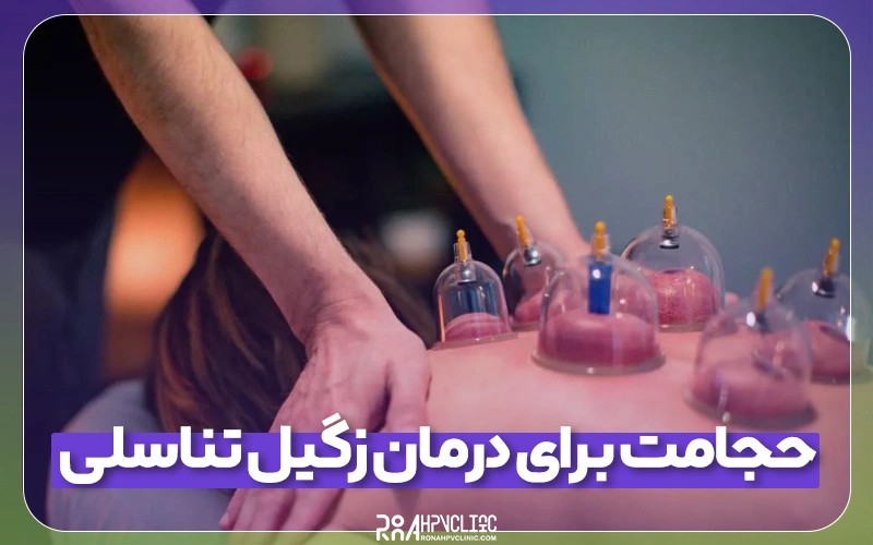 نقش حجامت برای درمان زگیل تناسلی