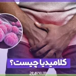 کلامیدیا چیست و چه علائمی در زنان و مردان دارد؟