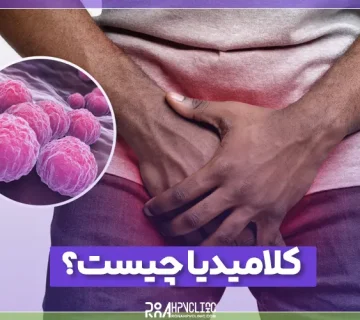 کلامیدیا چیست و چه علائمی در زنان و مردان دارد؟