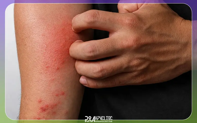 اچ آی وی جزو بیماری های مقاربتی شایع و خطرناک