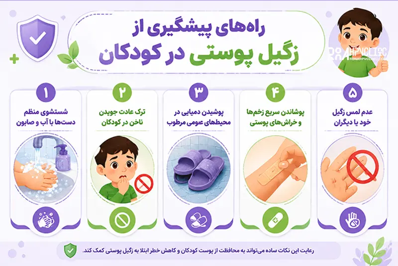 راه های پیشگیری از زگیل در کودکان