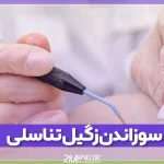 سوزاندن زگیل تناسلی چیست و چگونه انجام می شود