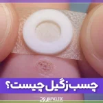 چسب زگیل چیست و چگونه استفاده می شود؟