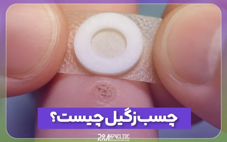 چسب زگیل چیست و چگونه استفاده می شود؟