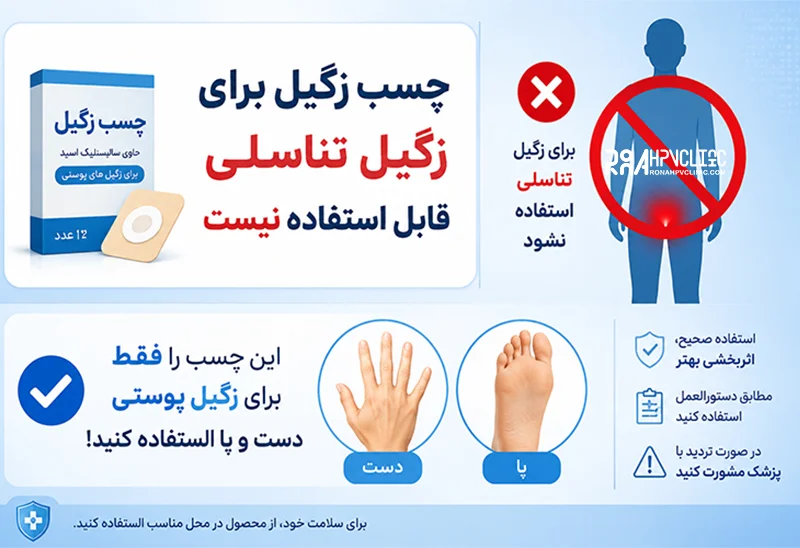 چسب زگیل چیست و چگونه زگیل را درمان میکند؟🩹 + نحوه استفاده 3 چسب نواری برای زگیل تناسلی