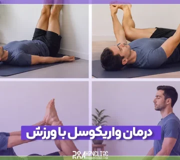 بهترین راه های درمان واریکوسل با ورزش