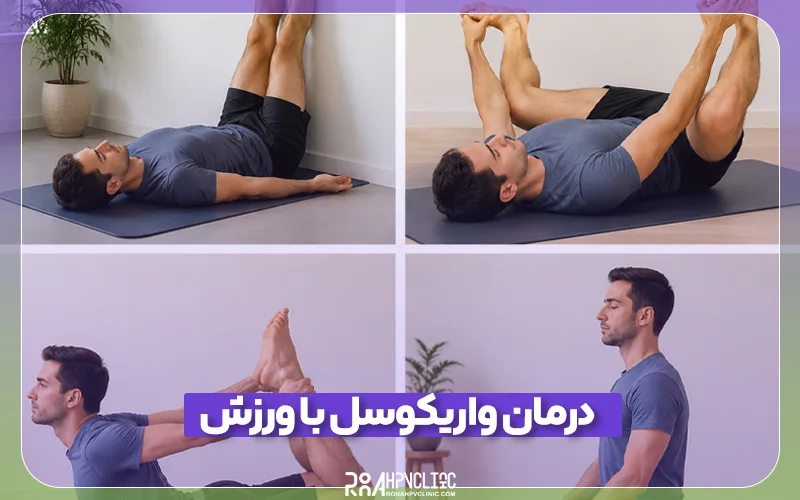 بهترین راه های درمان واریکوسل با ورزش