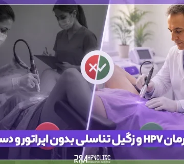 درمان HPV و زگیل تناسلی بدون دستیار و اپراتور