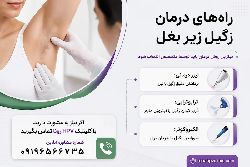 راه های درمان زگیل زیر بغل