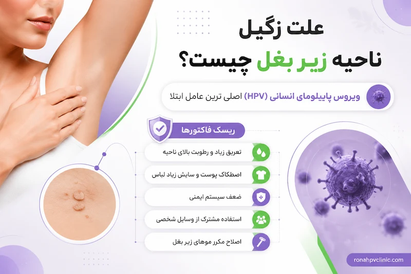 علت زگیل زیر بغل چیست؟