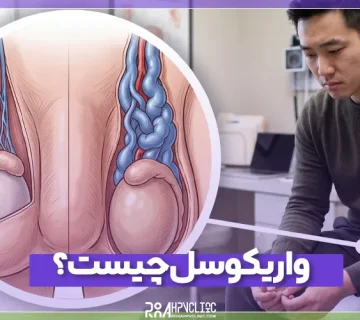 واریکوسل چیست و چه علائمی دارد؟