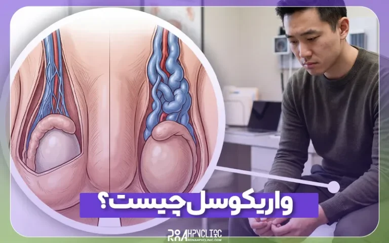 واریکوسل چیست و چه علائمی دارد؟