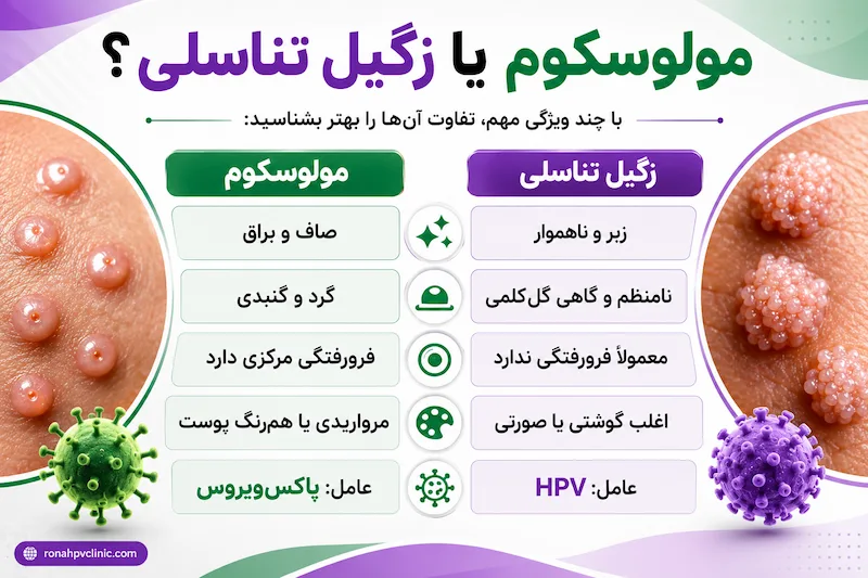 تفاوت مولوسکوم و زگیل تناسلی چیست؟ 8 تفاوت مولوسکوم و زگیل تناسلی از جنبه های مختلف