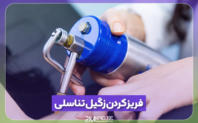 کلینیک hpv رونا 190 فریز کردن زگیل تناسلی چیست؟