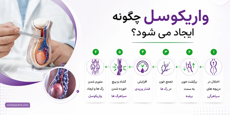 واریکوسل چگونه ایجاد می شود و علت آن چیست؟