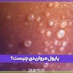 پاپول مرواریدی چیست و چه علائمی دارد؟